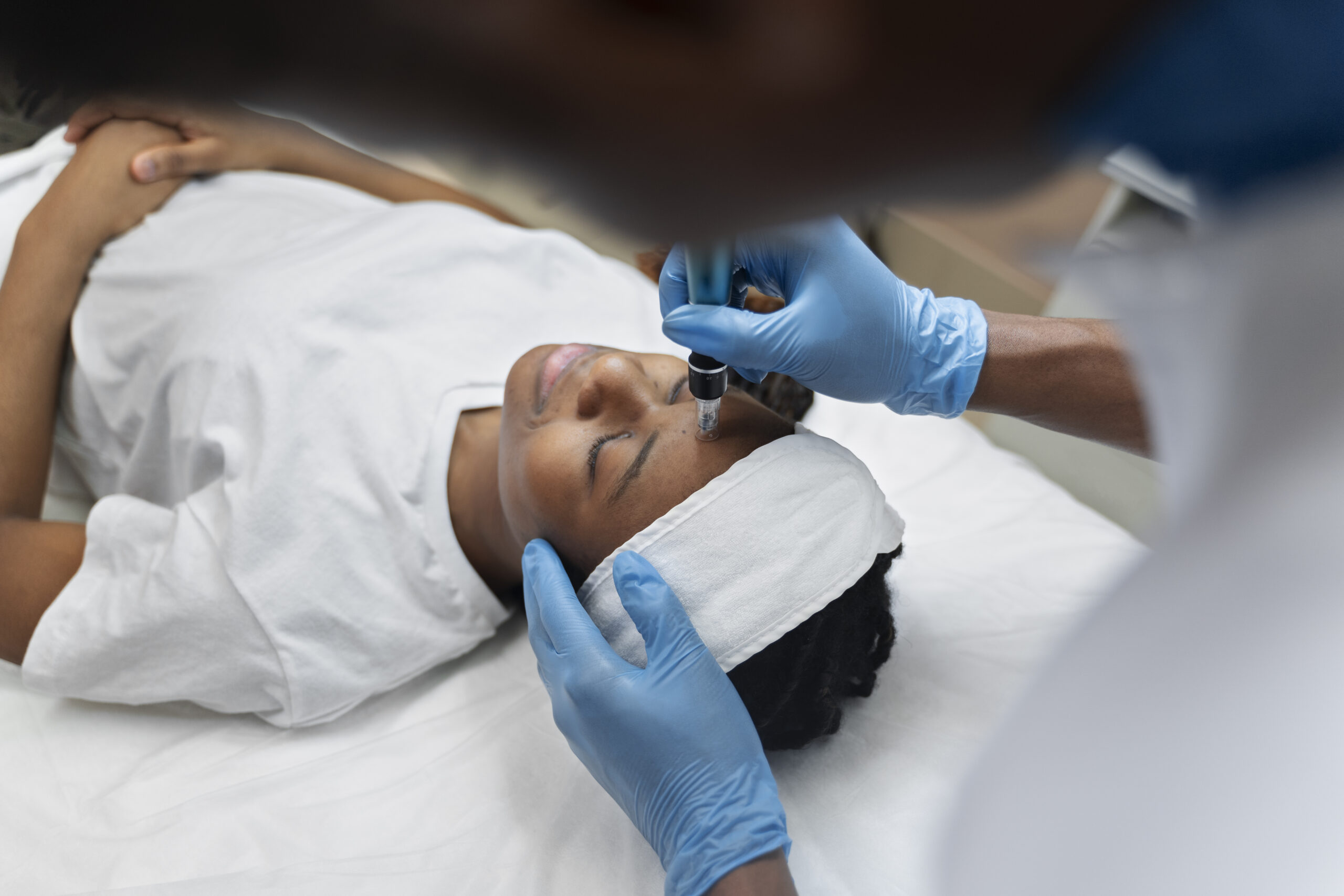 Facial with PRP & Microneedling