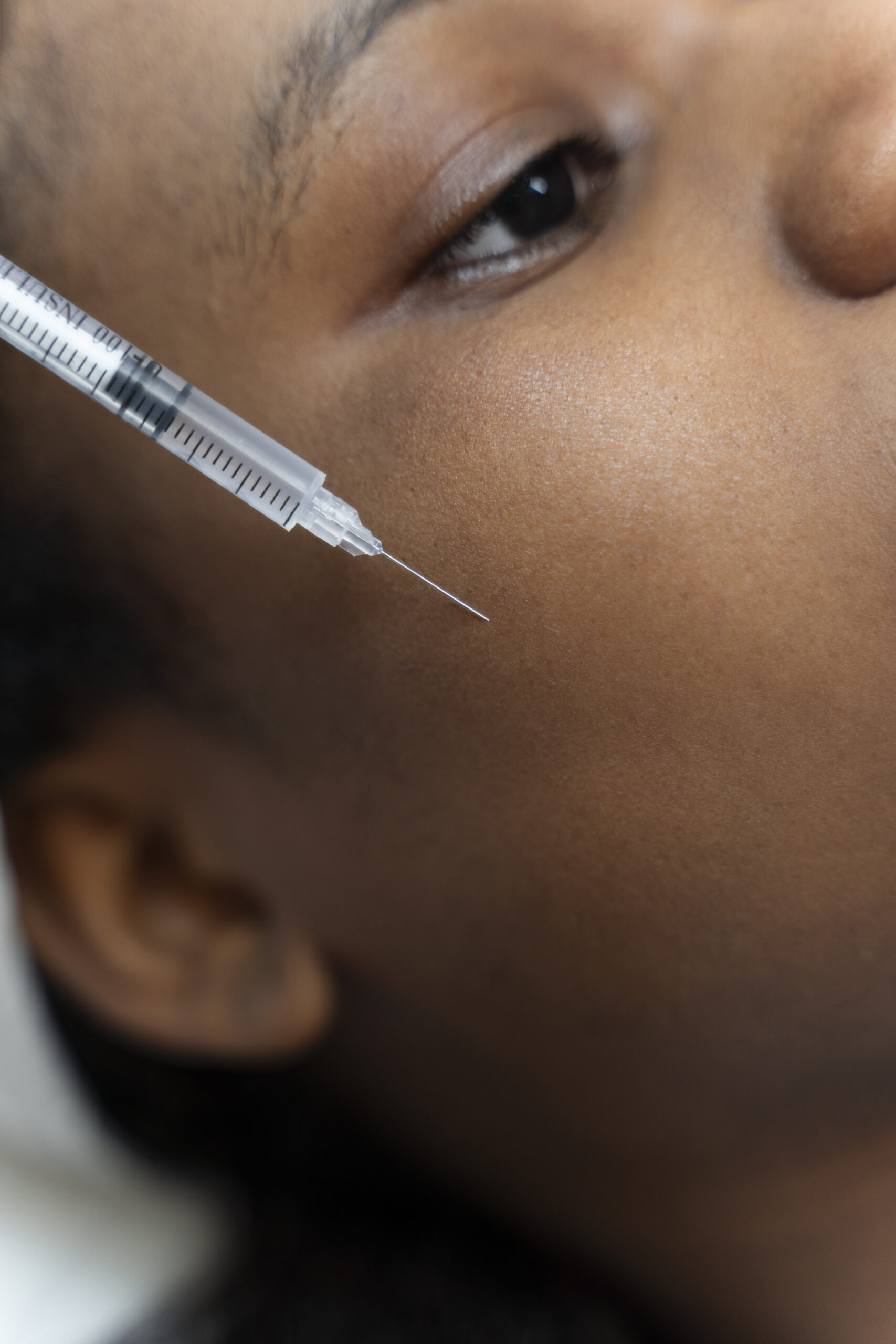 Botox & Dermal Filler